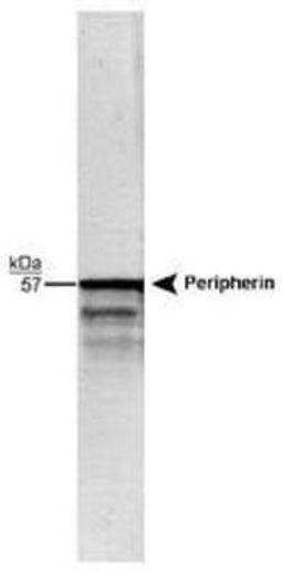 Western Blot: Peripherin Antibody [NB300-137] Detection of the 57 kDa peripherin protein in whole rat brain stem homogenate using NB 300-137 (1:20,000).  The faint 48 kDa band is a peripherin molecule.