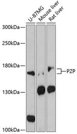 Western blot - PZP antibody (A3324)