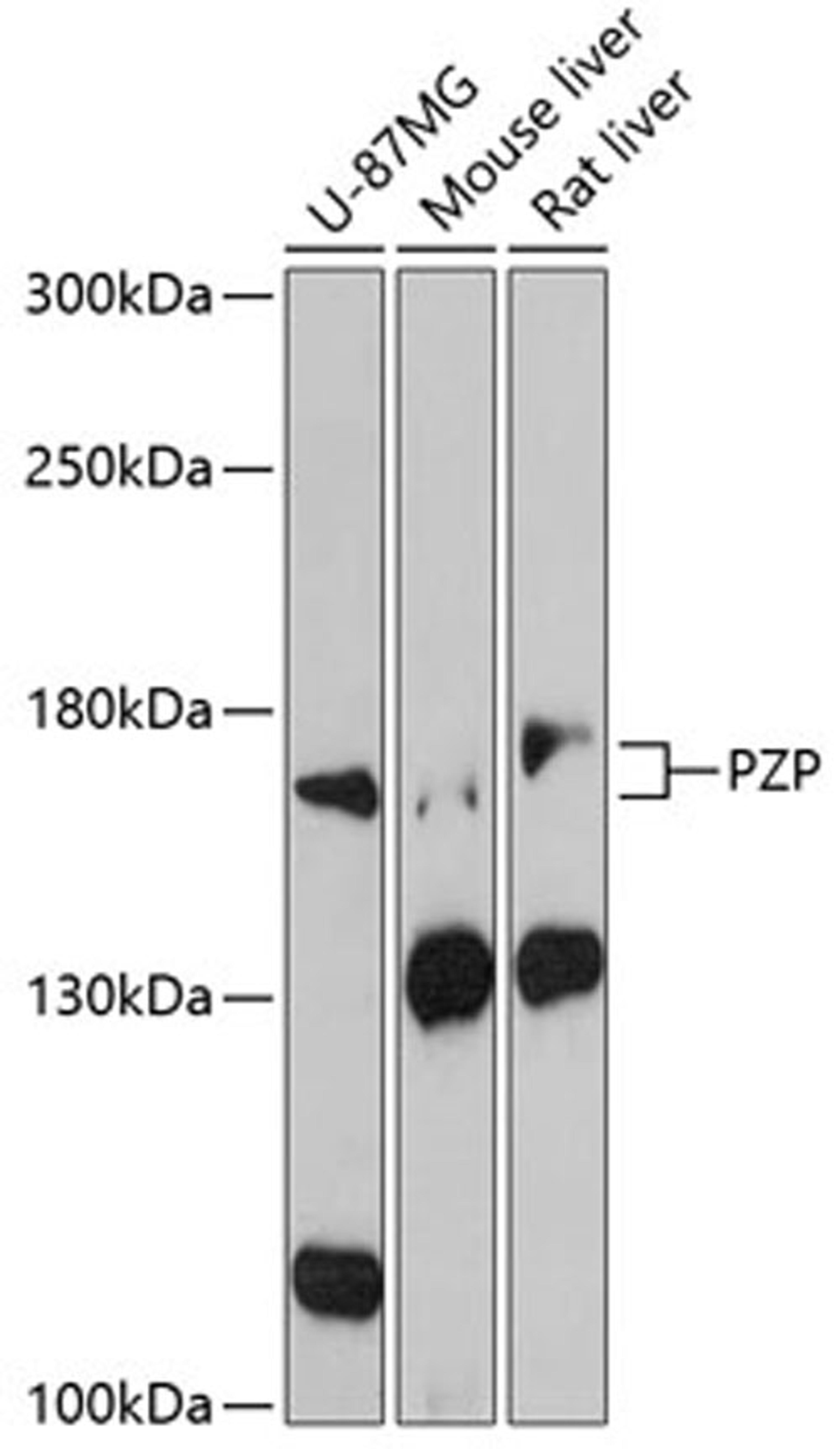 Western blot - PZP antibody (A3324)