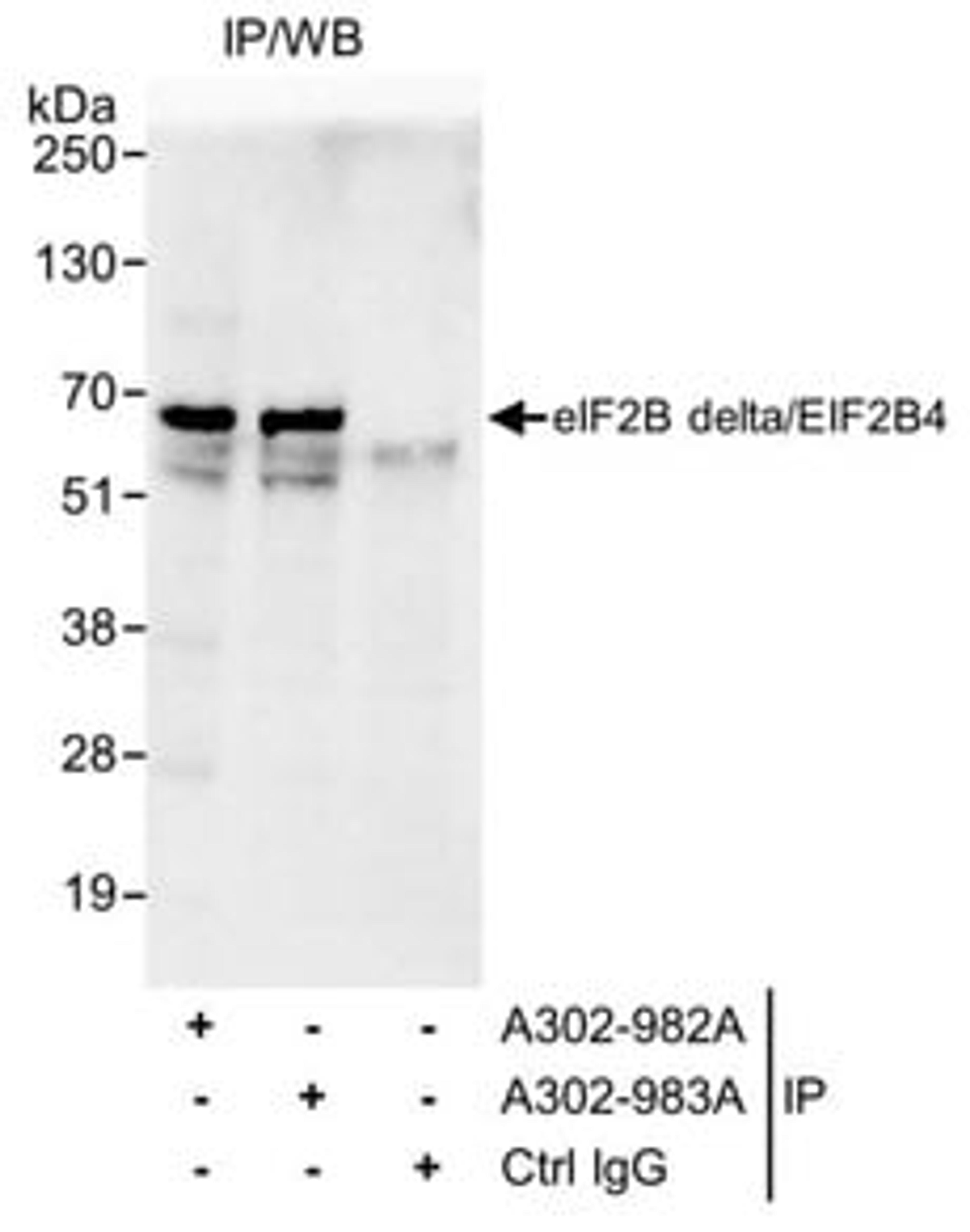 Detection of human eIF2B delta/EIF2B4 by western blot of immunoprecipitates.