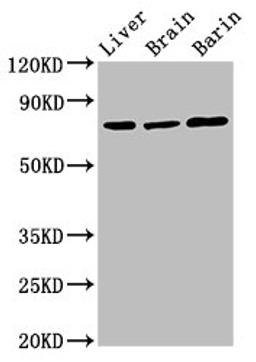 Western Blot. Positive WB detected in: Rat liver tissue, Rat brain tissue, Mouse brain tissue. All lanes: Hspa5 antibody at 3ug/ml. Secondary. Goat polyclonal to rabbit IgG at 1/50000 dilution. Predicted band size: 73 kDa. Observed band size: 73 kDa. 