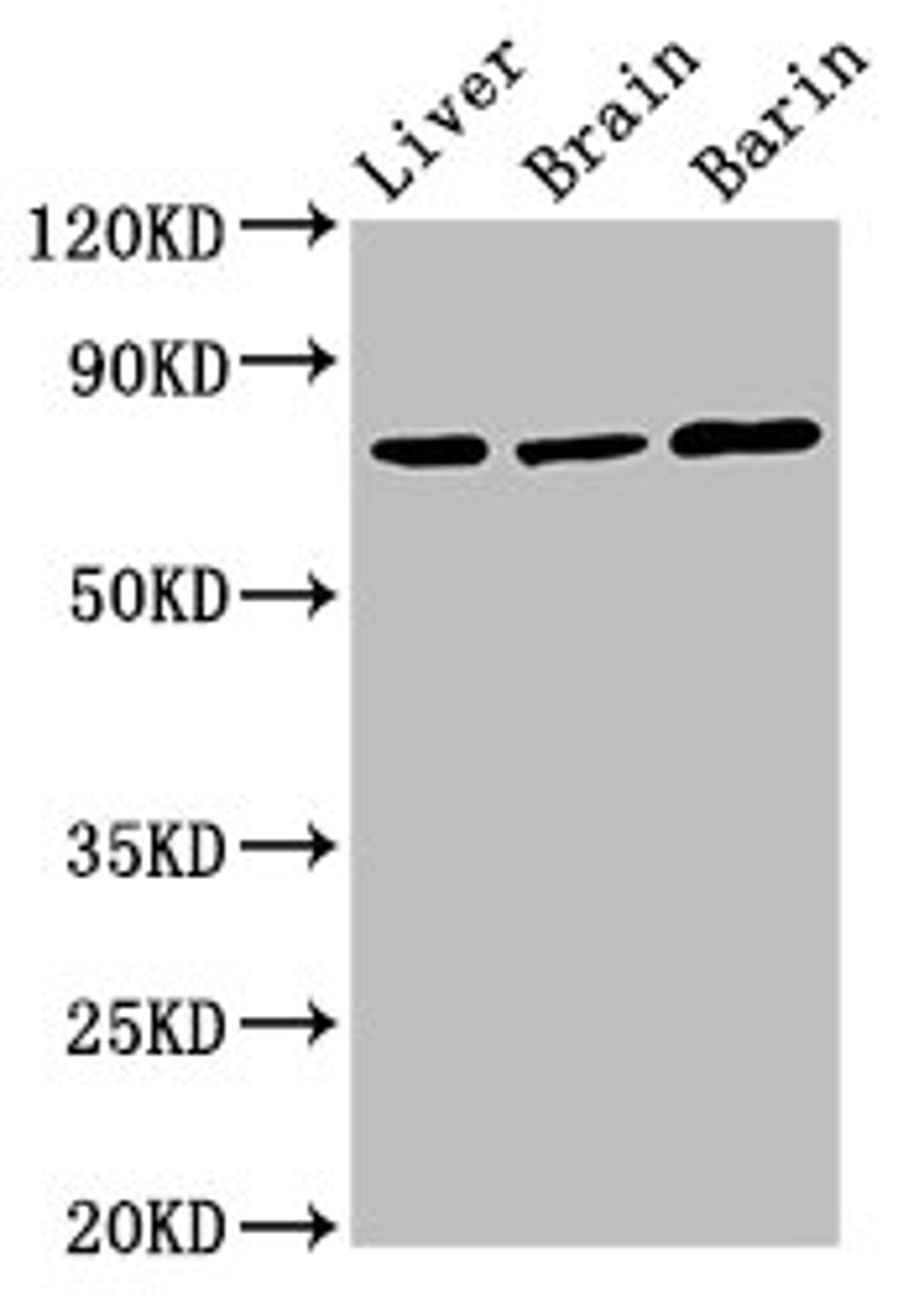 Western Blot. Positive WB detected in: Rat liver tissue, Rat brain tissue, Mouse brain tissue. All lanes: Hspa5 antibody at 3ug/ml. Secondary. Goat polyclonal to rabbit IgG at 1/50000 dilution. Predicted band size: 73 kDa. Observed band size: 73 kDa. 