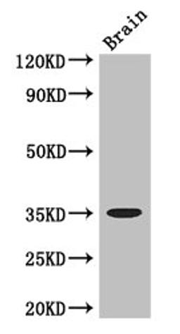 Western Blot. Positive WB detected in: Mouse brain tissue. All lanes: MYOD1 antibody at 3ug/ml. Secondary. Goat polyclonal to rabbit IgG at 1/50000 dilution. Predicted band size: 35 kDa. Observed band size: 35 kDa. 