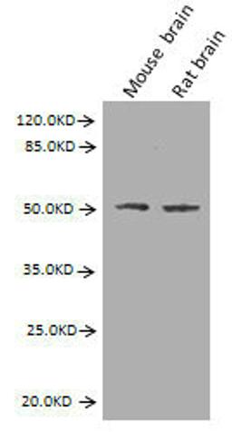 Western Blot. Positive WB detected in: Mouse brain tissue, Rat brain tissue. All lanes: GFAP antibody at 2.7µg/ml. Secondary. Goat polyclonal to Mouse IgG at 1/10000 dilution. Predicted band size: 50, 51 kDa. Observed band size: 50 kDa. 