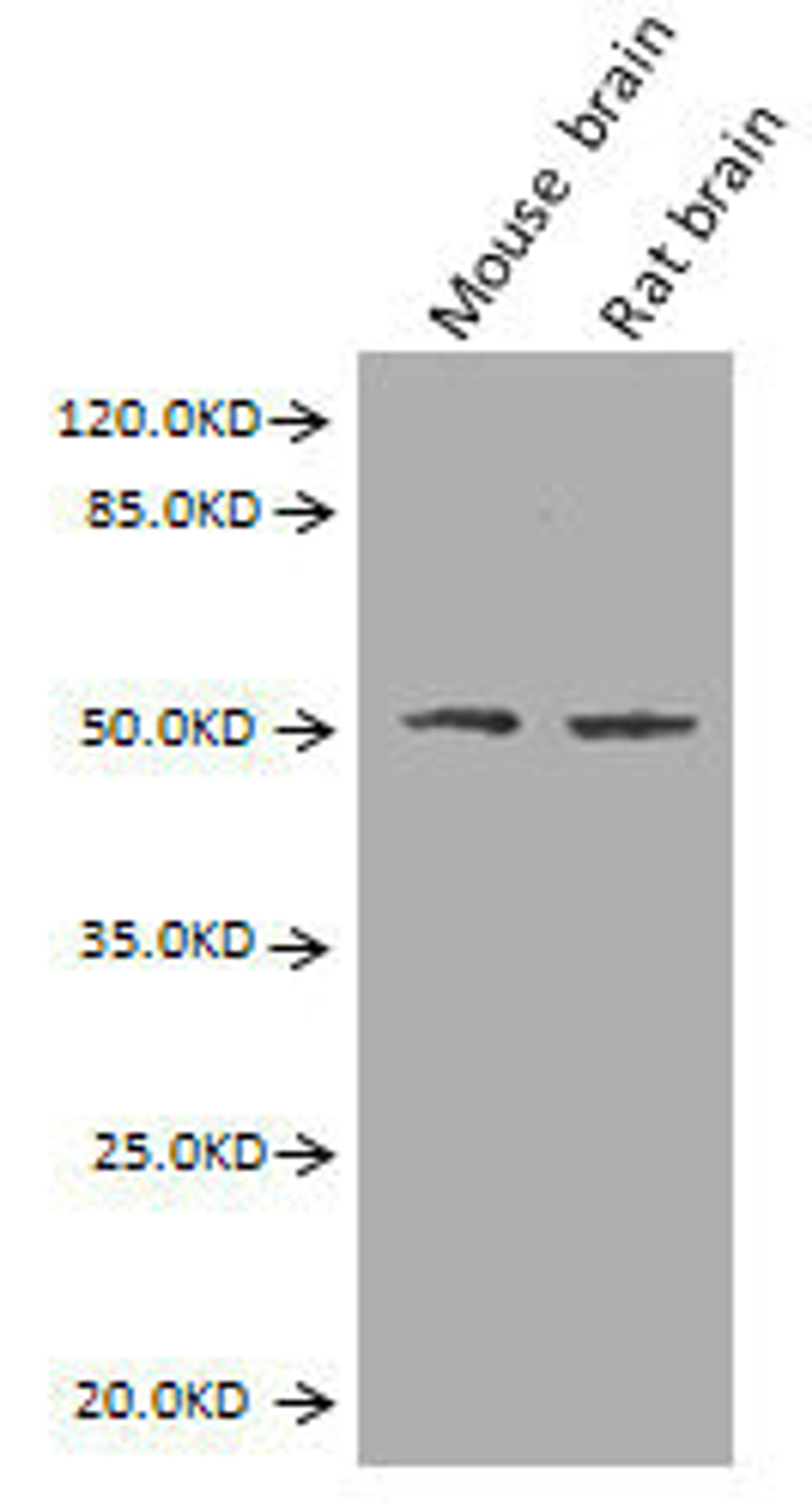Western Blot. Positive WB detected in: Mouse brain tissue, Rat brain tissue. All lanes: GFAP antibody at 2.7µg/ml. Secondary. Goat polyclonal to Mouse IgG at 1/10000 dilution. Predicted band size: 50, 51 kDa. Observed band size: 50 kDa. 