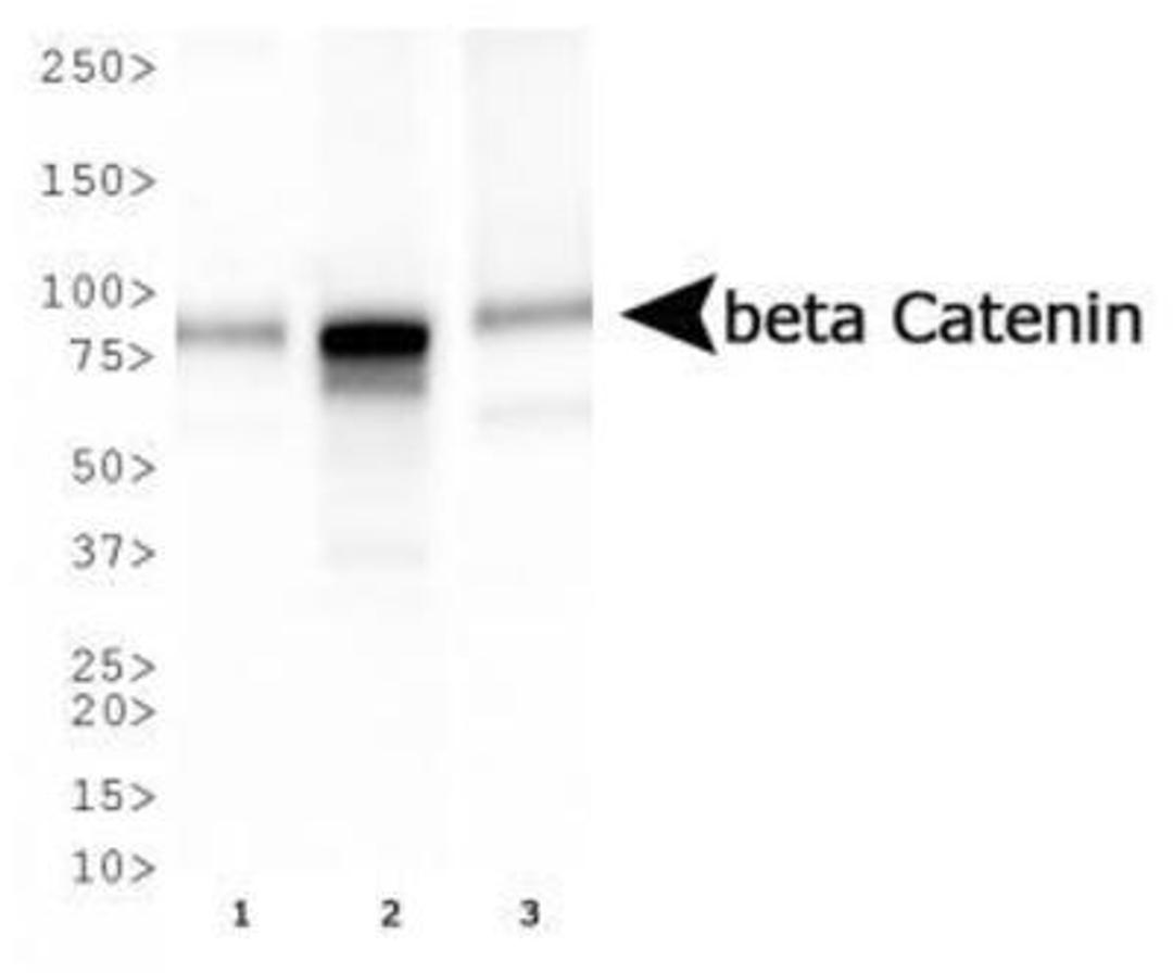 Western Blot: beta-Catenin Antibody (12F7) [NBP1-54467] - Western blot analysis of beta Catenin expression in 1) HepG2, 2) MCF7, and 3) Cos7 whole cell lysates using NBP1-54467.