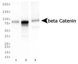 Western Blot: beta-Catenin Antibody (12F7) [NBP1-54467] - Western blot analysis of beta Catenin expression in 1) HepG2, 2) MCF7, and 3) Cos7 whole cell lysates using NBP1-54467.