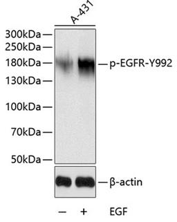 Western blot - Phospho-EGFR-Y992 antibody (AP0026)