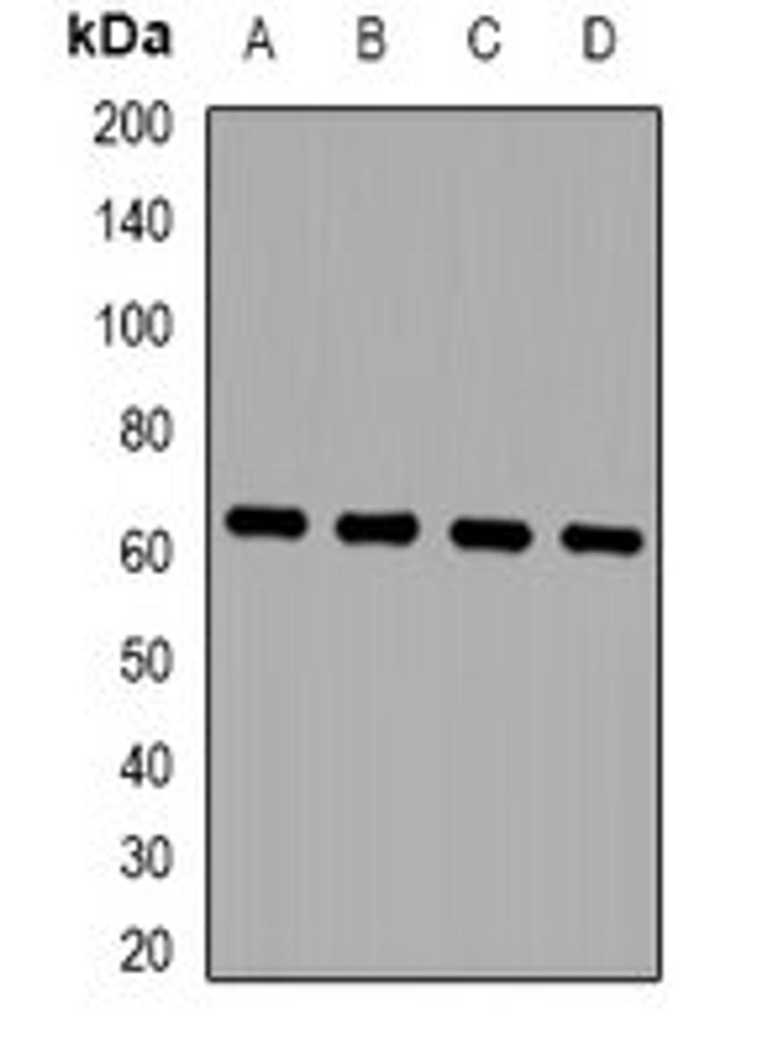 Western blot analysis of MCF7 (Lane1), HepG2 (Lane2), mouse brain (Lane3), mouse lung (Lane4) whole cell lysates using ZKSCAN4 antibody