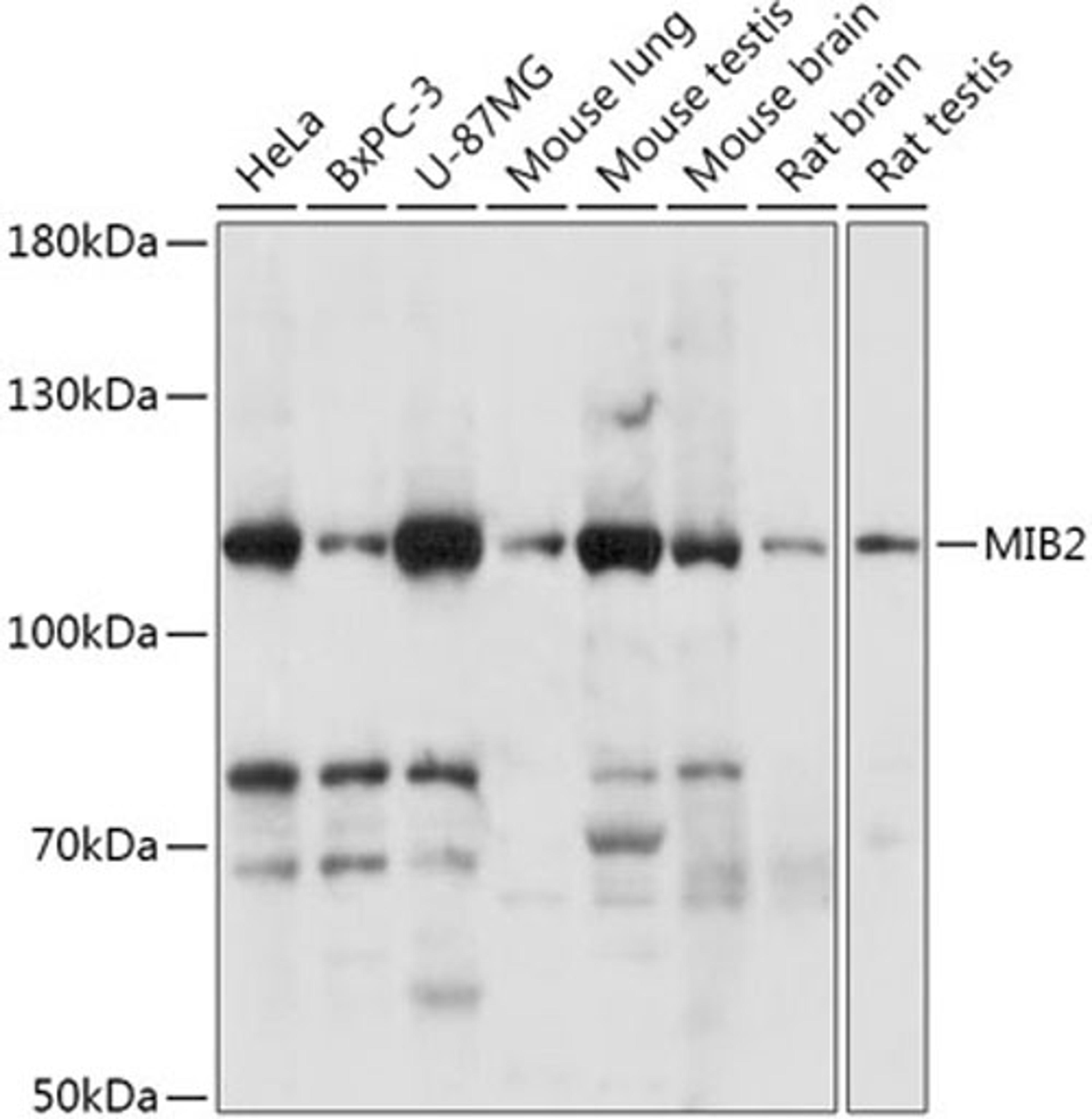 Western blot - MIB2 antibody (A17829)