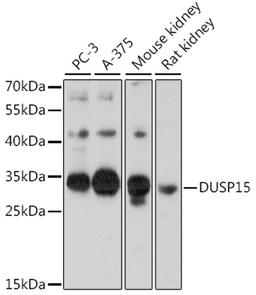 Western blot - DUSP15 antibody (A16322)