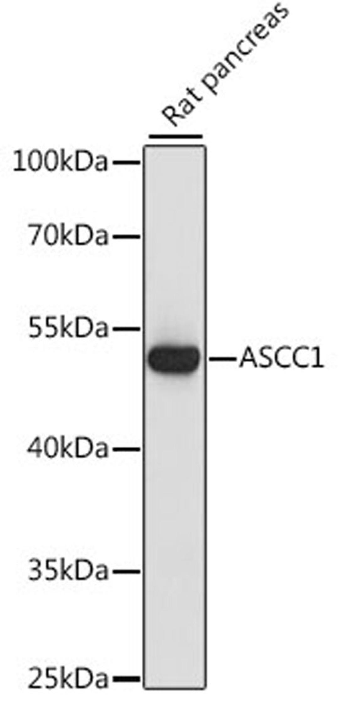 Western blot - ASCC1 antibody (A15832)