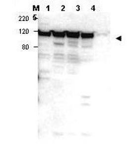 Western blot analysis of positive whole cell lysate - lane 1 Jurkat, lane 2 peripheral blood T cells, lane 3 human spleen and lane 4 300.19. Lane 5, 293 cells using Myosin 1G antibody