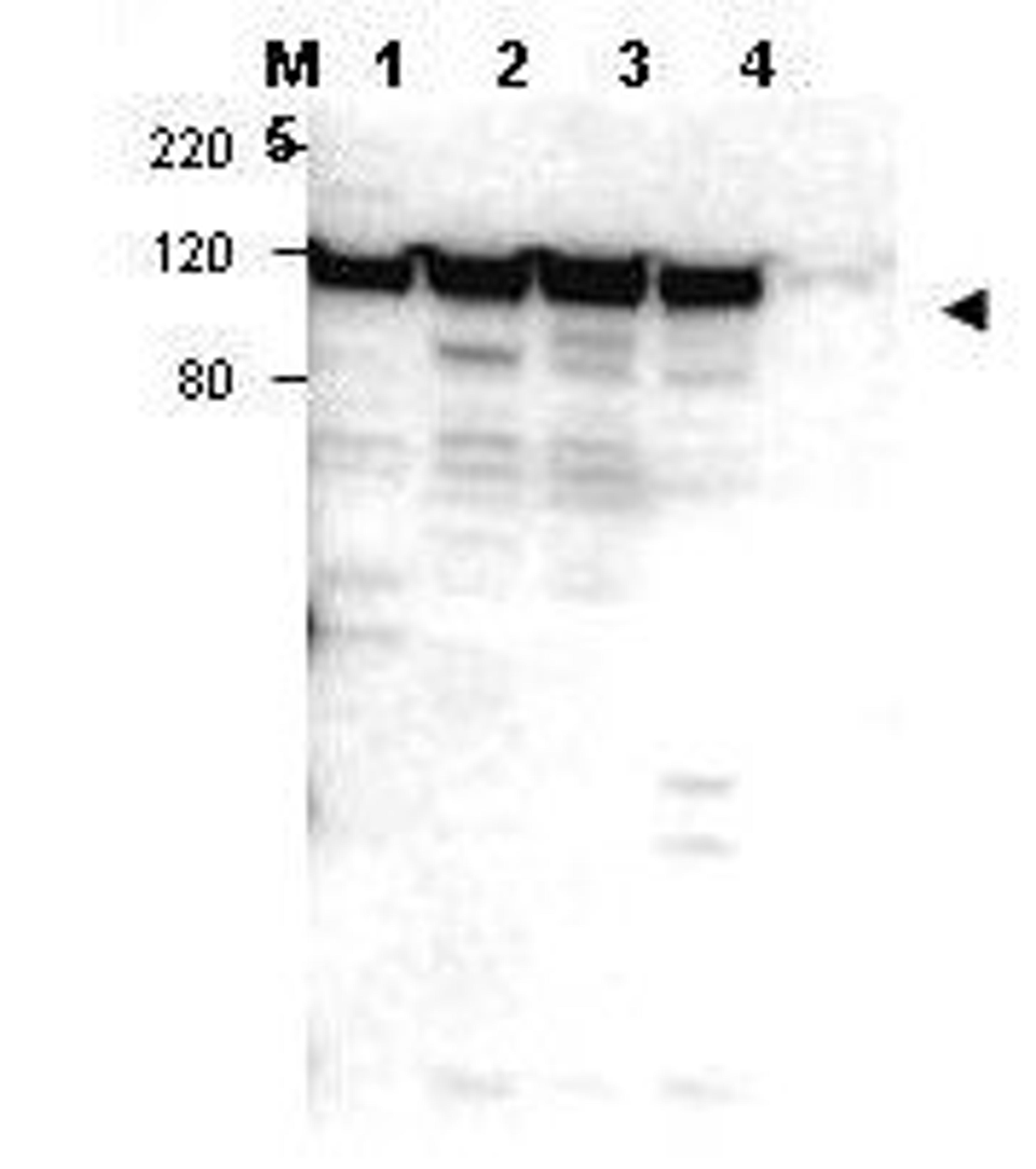 Western blot analysis of positive whole cell lysate - lane 1 Jurkat, lane 2 peripheral blood T cells, lane 3 human spleen and lane 4 300.19. Lane 5, 293 cells using Myosin 1G antibody