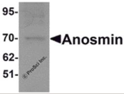 Western blot analysis of Anosmin in MCF7 cell lysate with Anosmin antibody at 1 μg/mL.