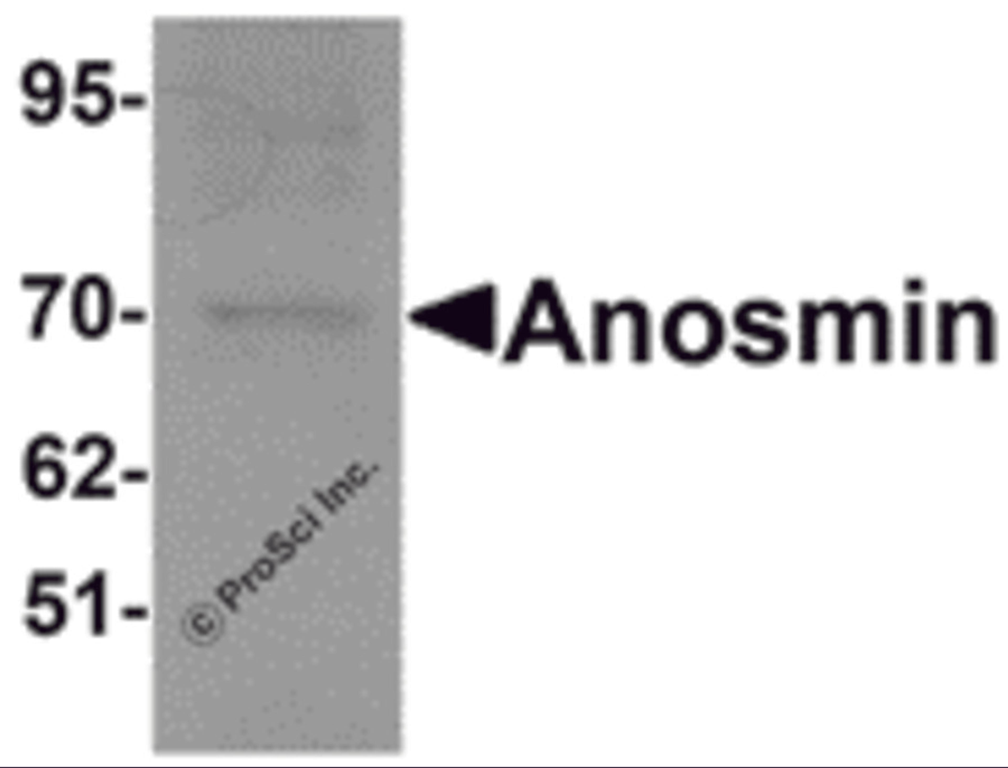 Western blot analysis of Anosmin in MCF7 cell lysate with Anosmin antibody at 1 μg/mL.
