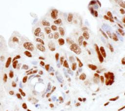 Detection of human SS-B by immunohistochemistry.