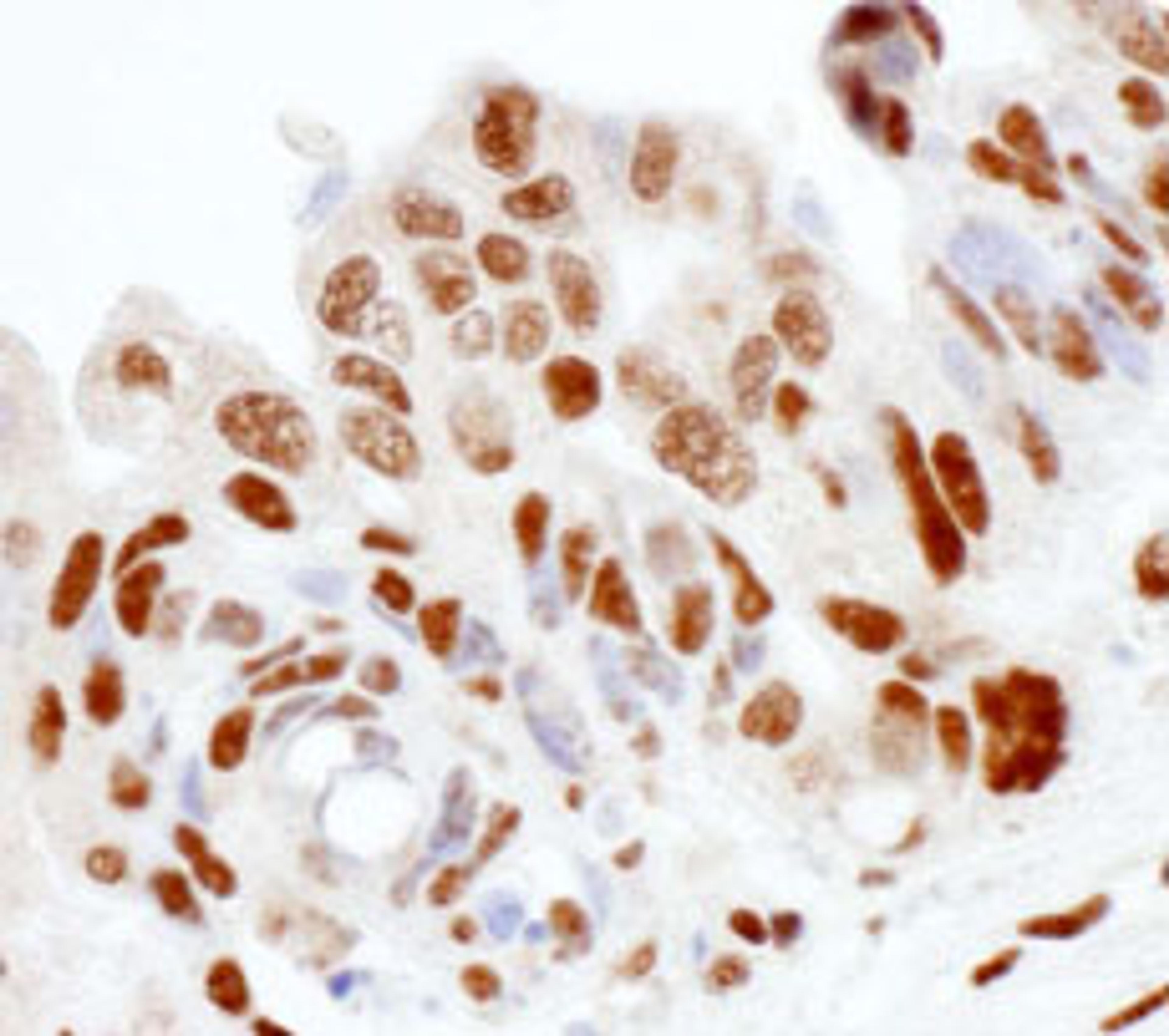 Detection of human SS-B by immunohistochemistry.