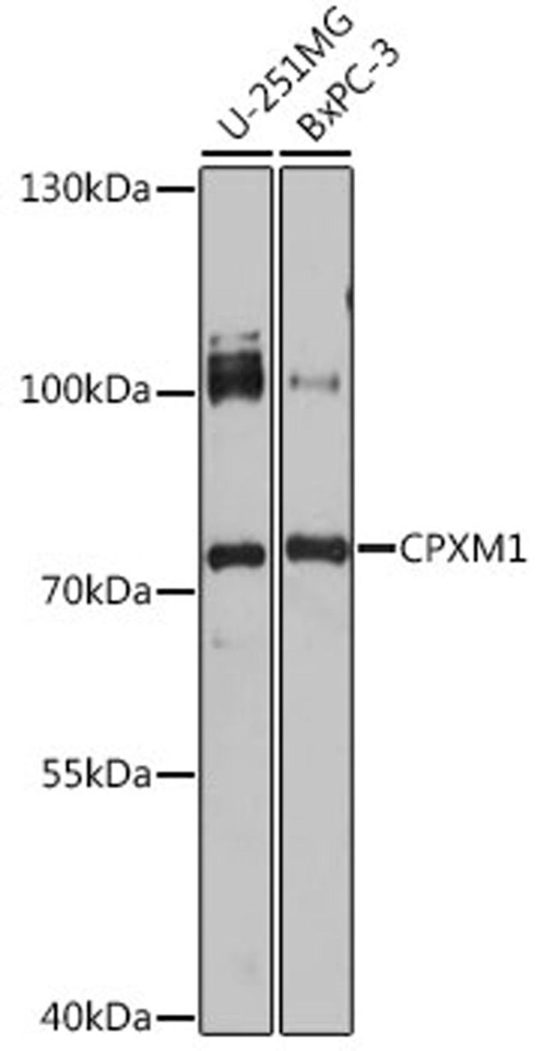 Western blot - CPXM1 antibody (A16552)