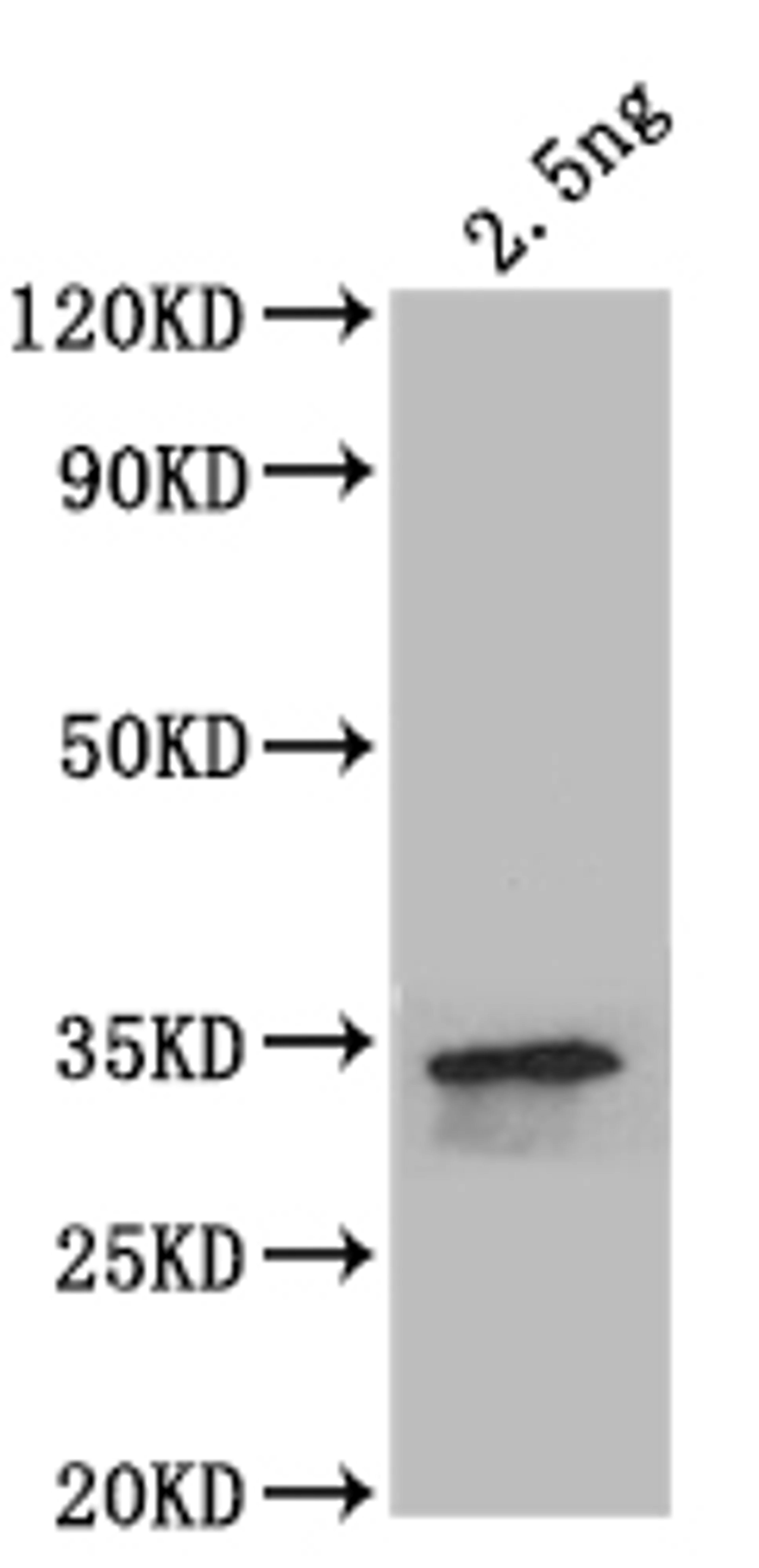 Western Blot. Positive WB detected in: recombinant protein. All lanes: beta-Spec Antibody at 1:1000. Secondary. Goat polyclonal to rabbit IgG at 1/50000 dilution. Predicted band size: 35.4 kDa. Observed band size: 35.4 kDa. 