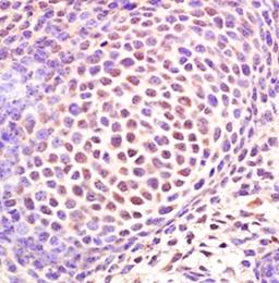 Paraffin-embedded mouse embryo tissue fixed with 4% paraformaldehyde. Antigen retrieval by boiling with citrate buffer. Blocking buffer is goat serum (37 degrees for 20 min.). Sp7/Osterix antibody at 1:200 dilution with overnight incubation at 4 degrees