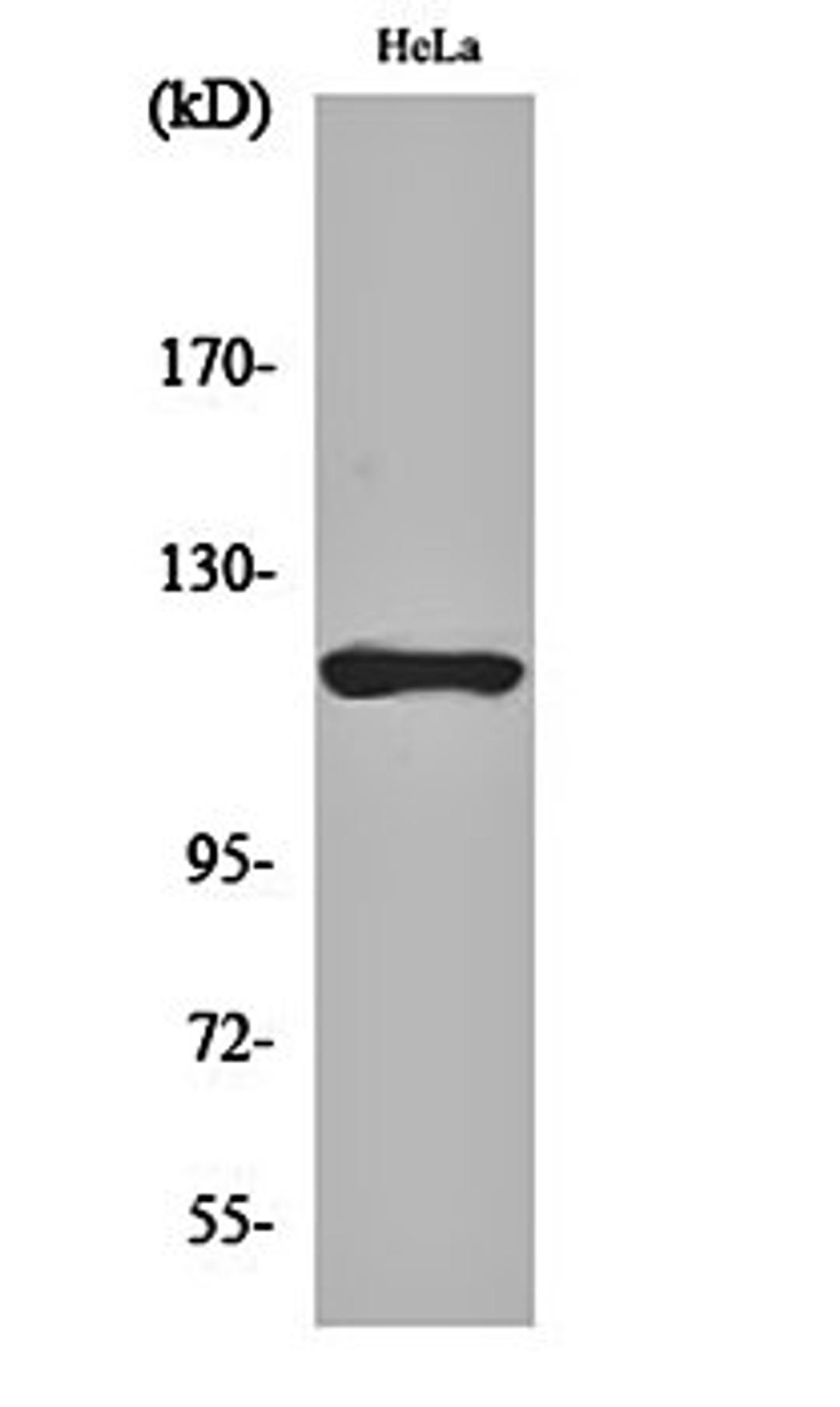 Western blot analysis of Hela cell lysates using HXK I antibody