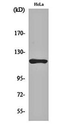 Western blot analysis of Hela cell lysates using HXK I antibody