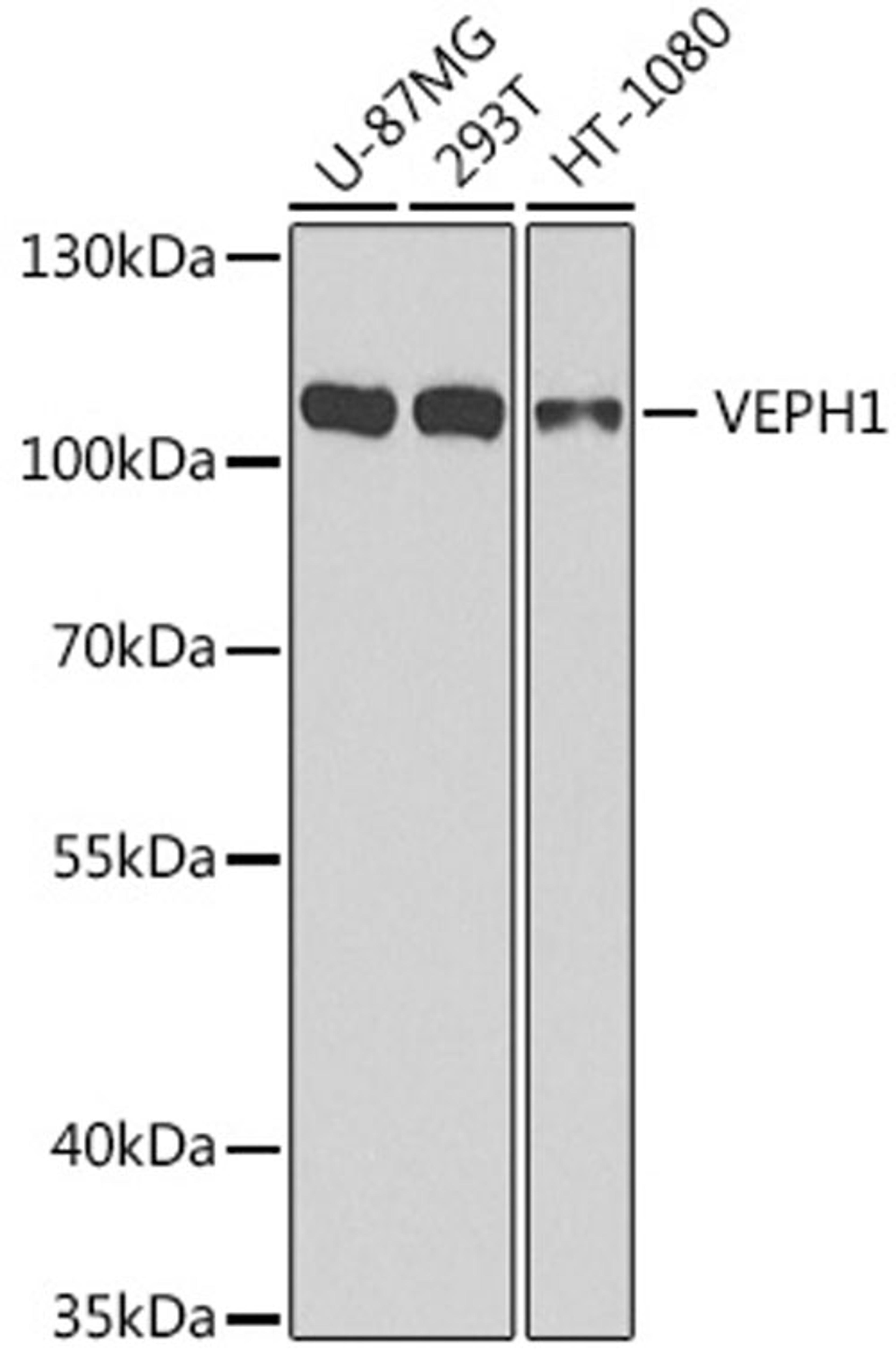 Western blot - VEPH1 antibody (A8510)