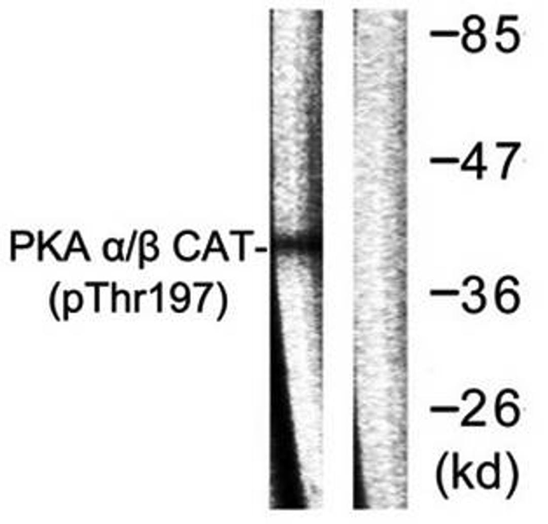 Western blot analysis of extracts from mouse brain cells using PKA alpha-beta CAT (phospho-Thr197) antibody