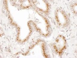 Detection of human TGOLN2 by immunohistochemistry.