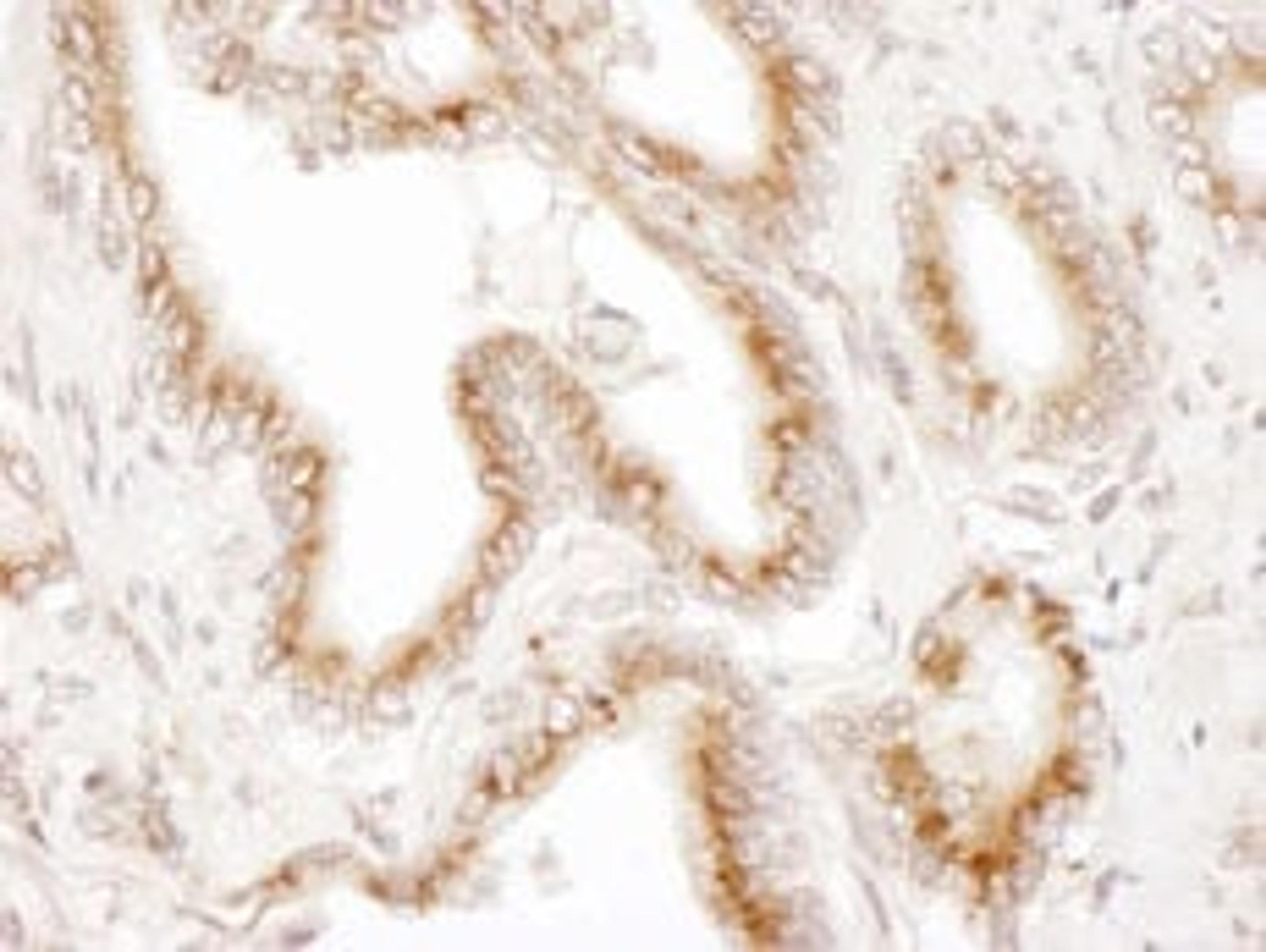 Detection of human TGOLN2 by immunohistochemistry.