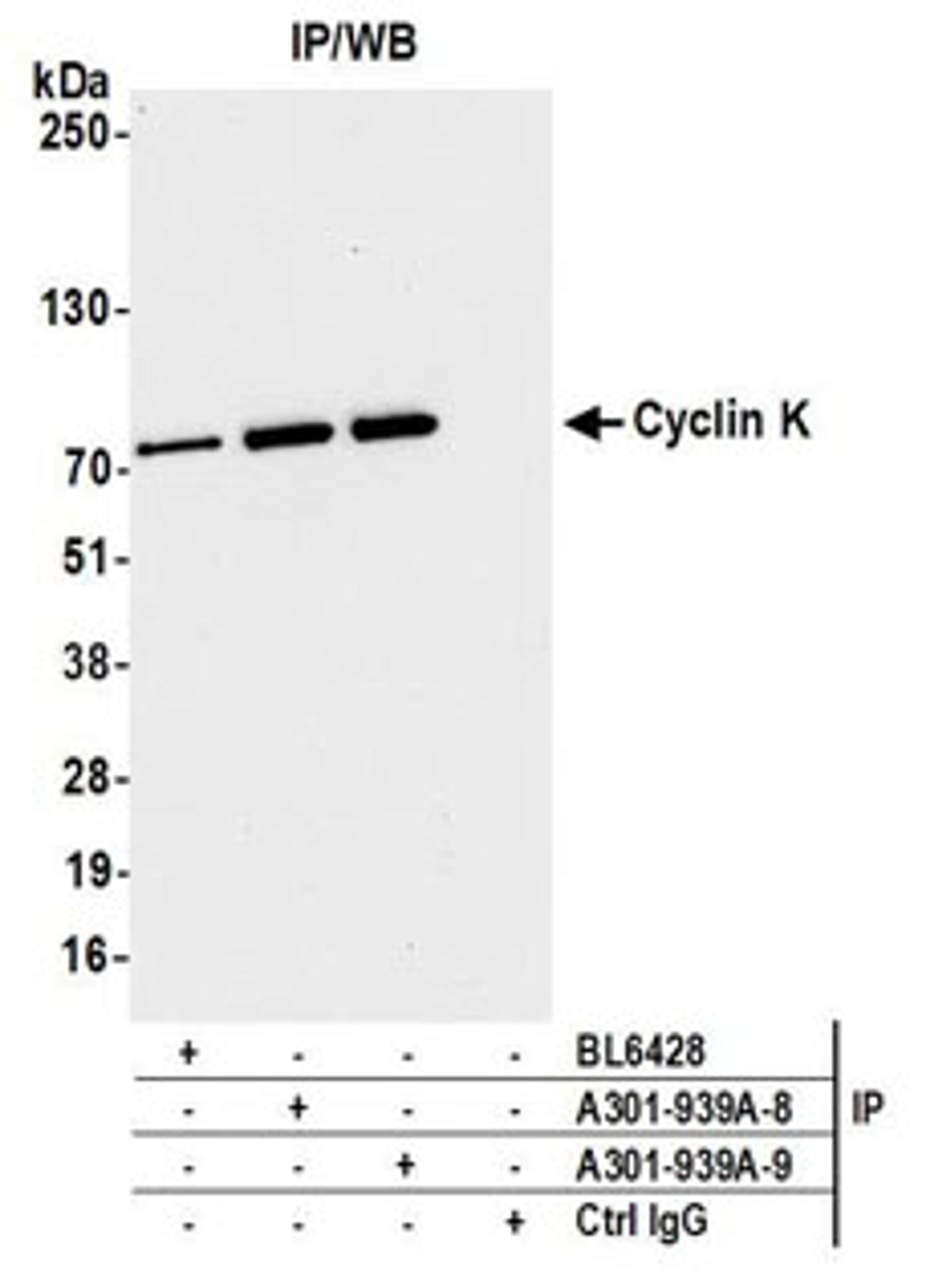 Detection of human Cyclin K by western blot of immunoprecipitates.