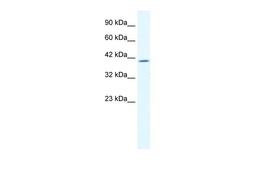 Antibody used in WB on Human Jurkat 2.5 ug/ml.