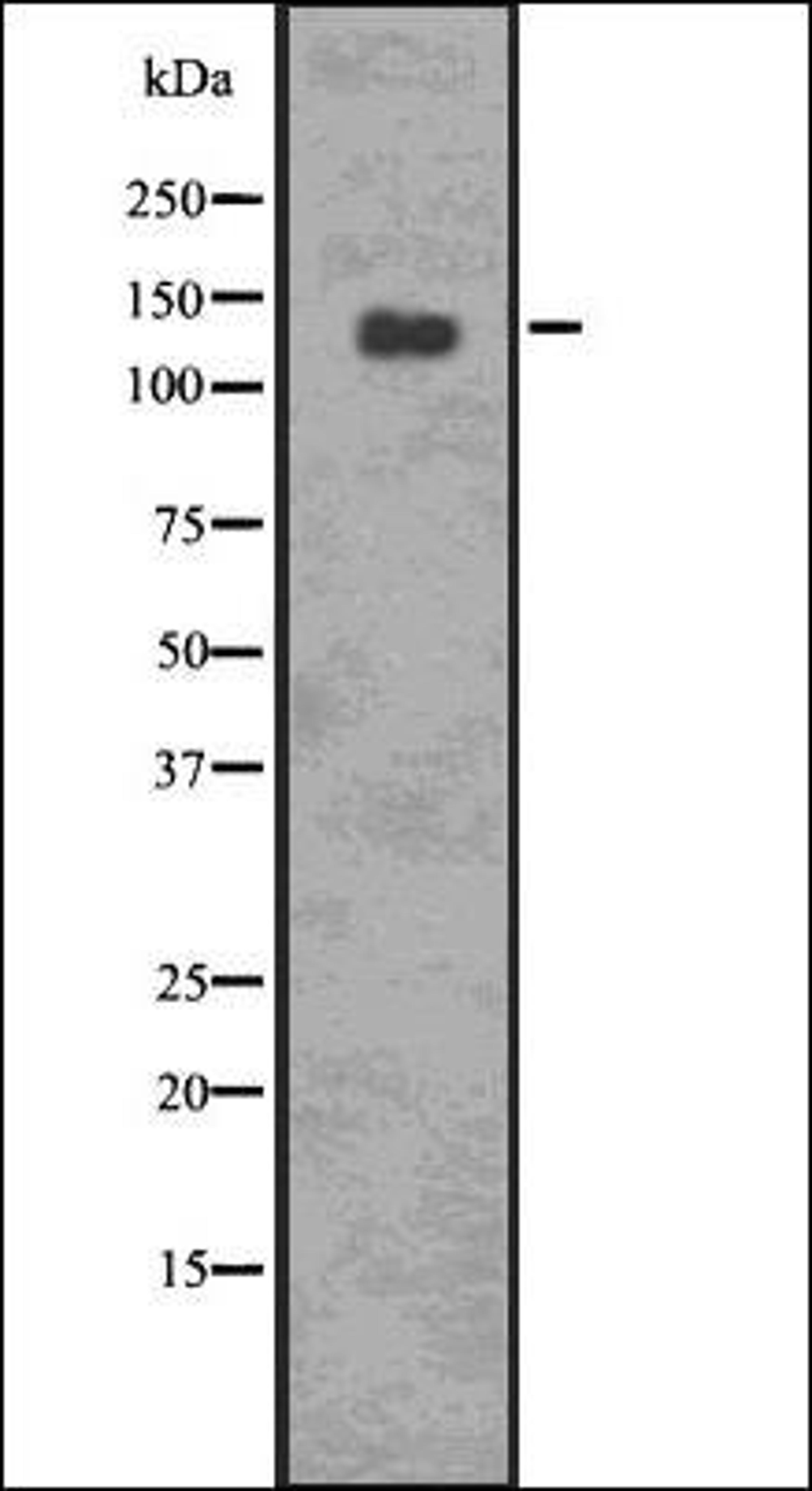 Western blot analysis of 293 whole cell lysates using p-PERK -Thr 981- antibody