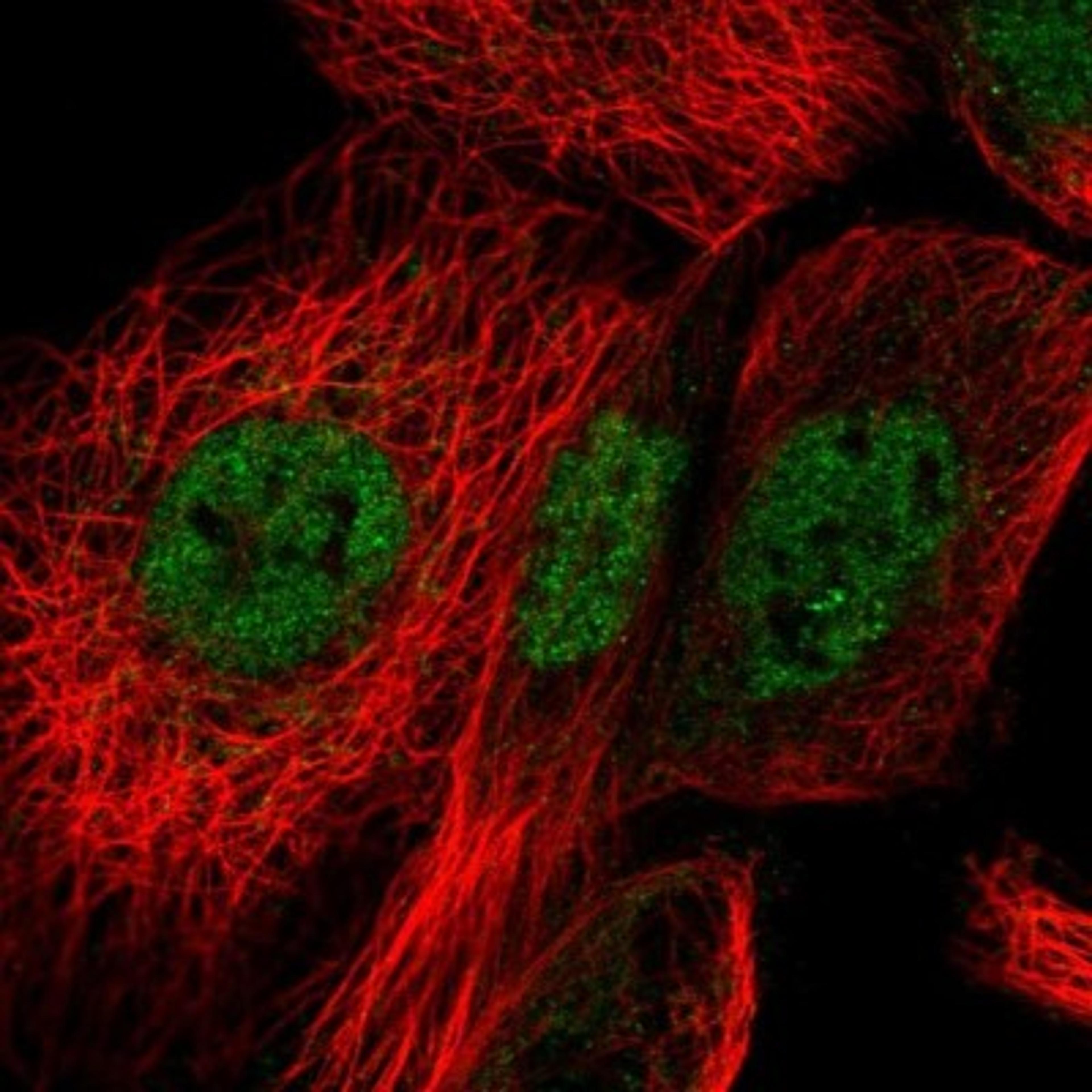 Immunofluorescence: BANF2 Antibody [NBP1-88718] - Staining of human cell line A-431 shows positivity in nucleus but not nucleoli.