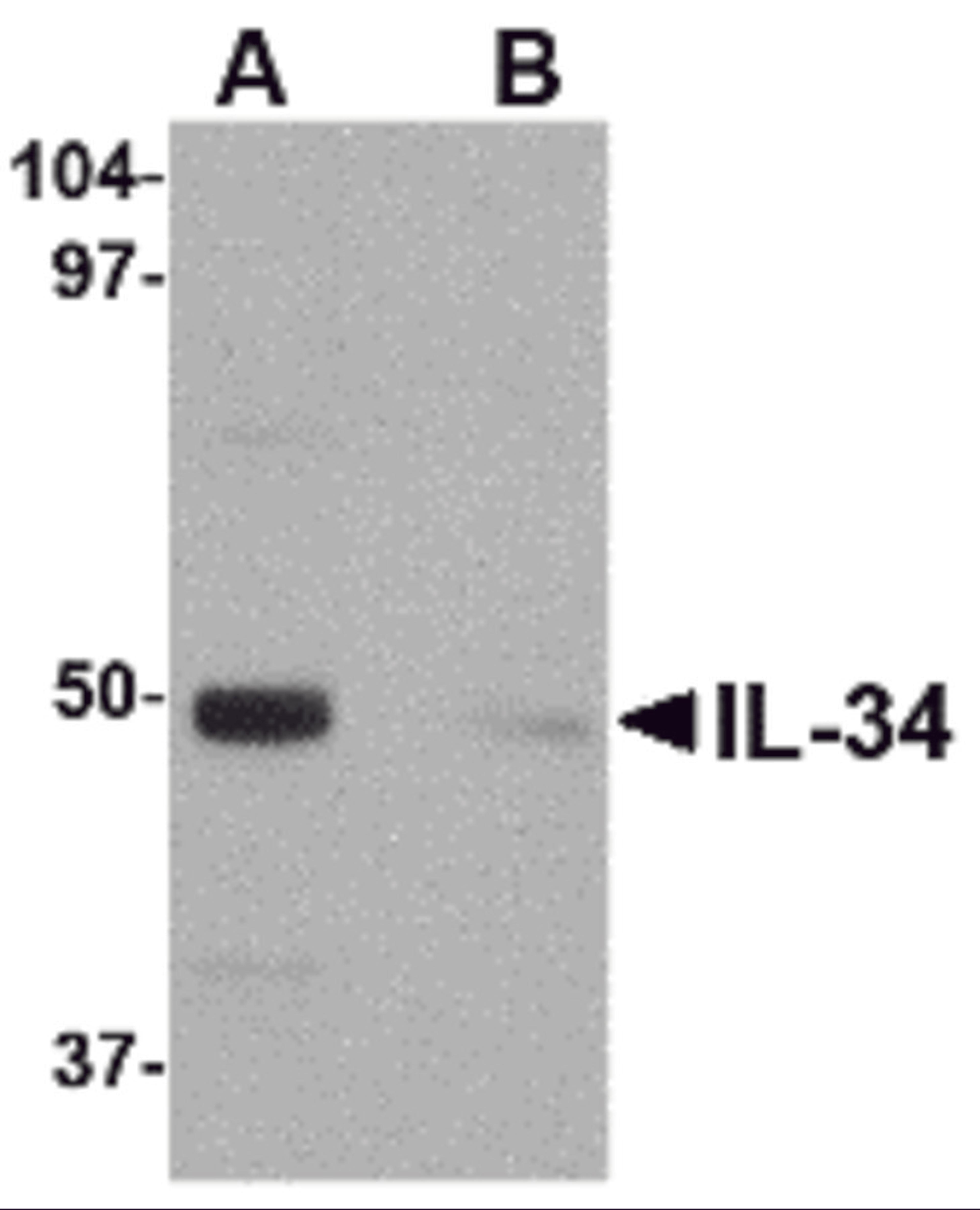 Western blot analysis of IL-34 in human brain tissue lysate with IL-34 antibody at 0.25 &#956;g/mL in (A) the absence and (B) the presence of blocking peptide.