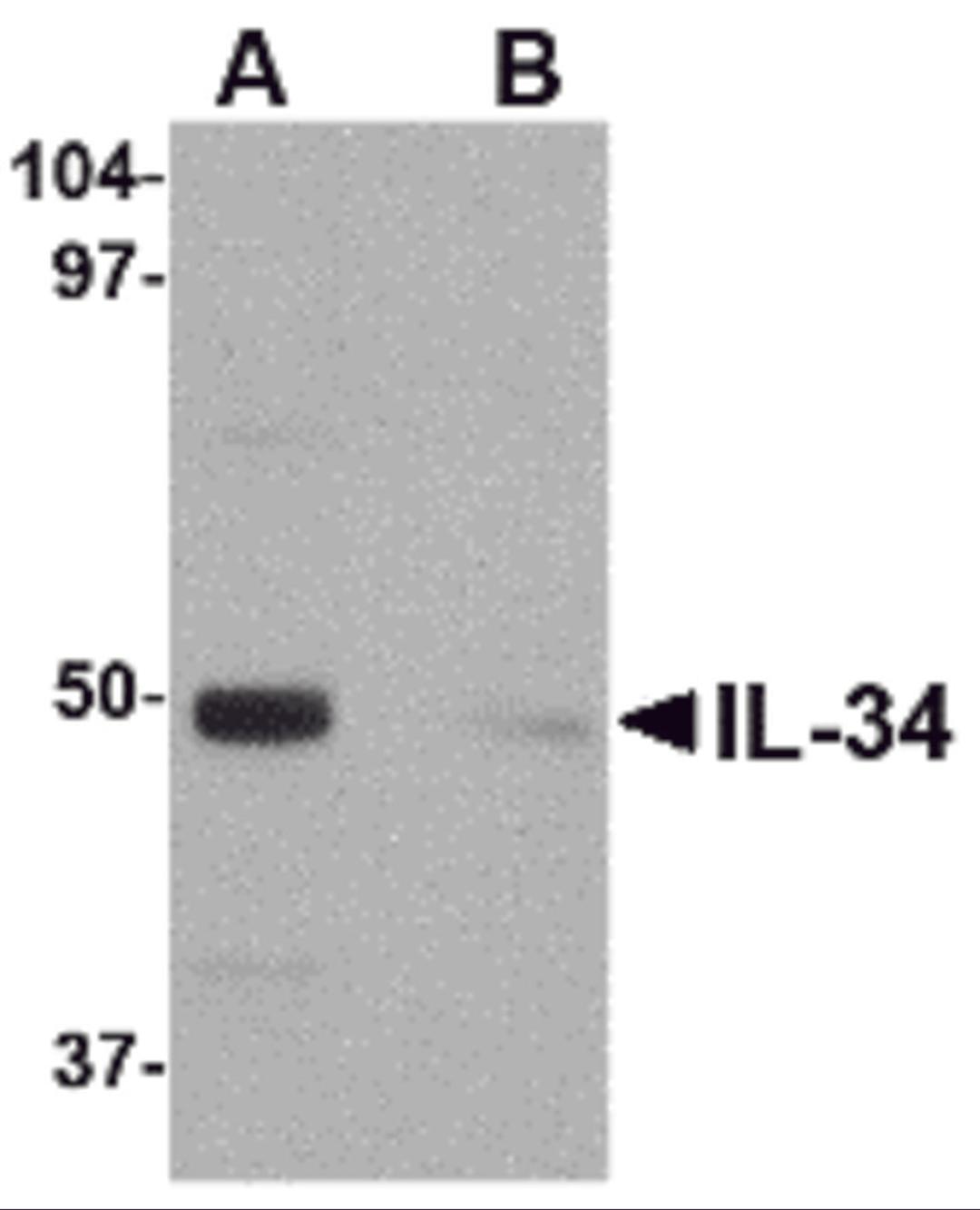 Western blot analysis of IL-34 in human brain tissue lysate with IL-34 antibody at 0.25 μg/mL in (A) the absence and (B) the presence of blocking peptide.