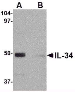 Western blot analysis of IL-34 in human brain tissue lysate with IL-34 antibody at 0.25 μg/mL in (A) the absence and (B) the presence of blocking peptide.