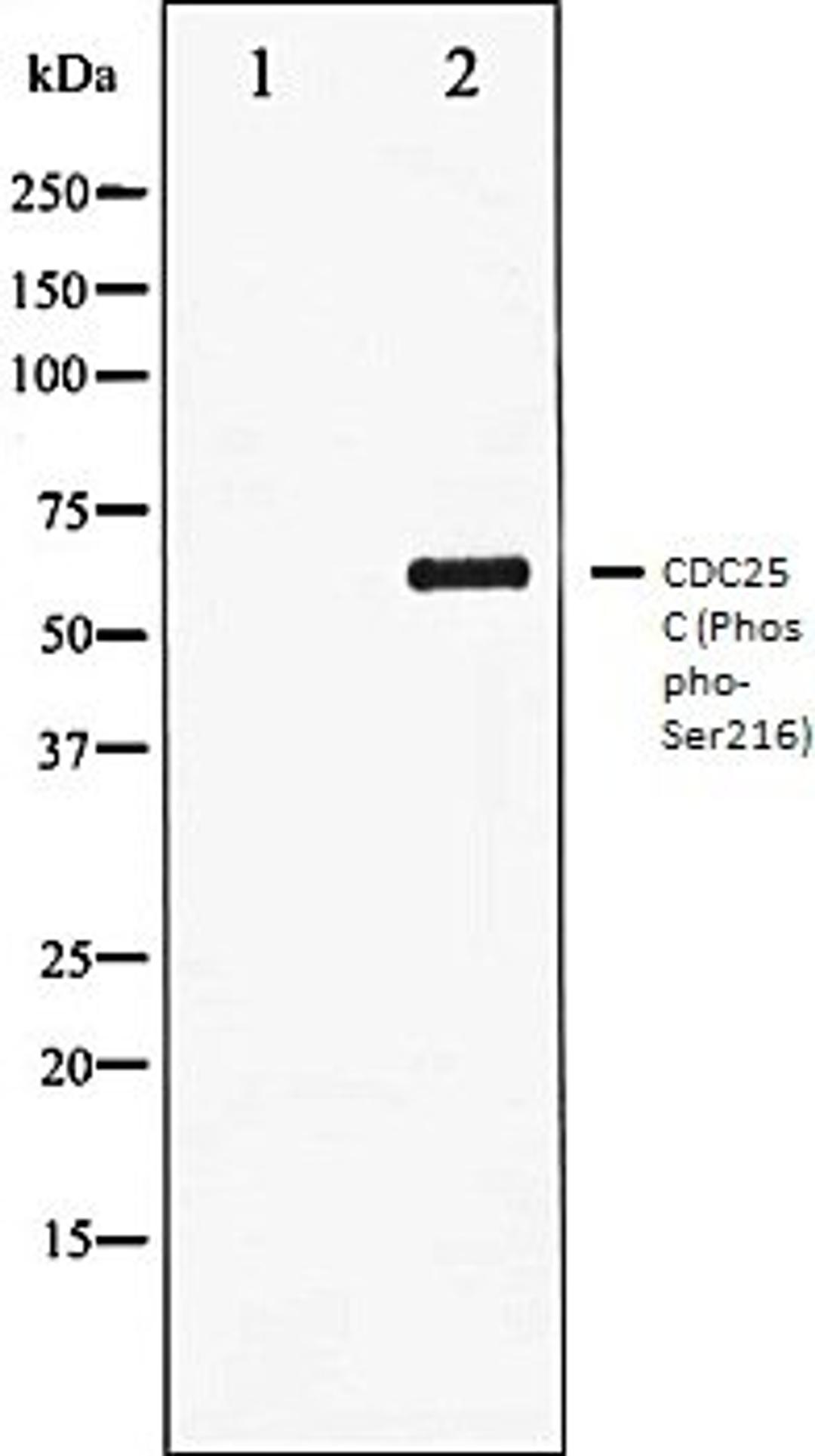 Western blot analysis of HuvEc whole cell lysates using CDC25C (Phospho-Ser216) antibody, The lane on the left is treated with the antigen-specific peptide.