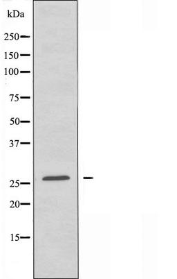 Western blot analysis of NIH/3T3 cells using OR7E5P antibody