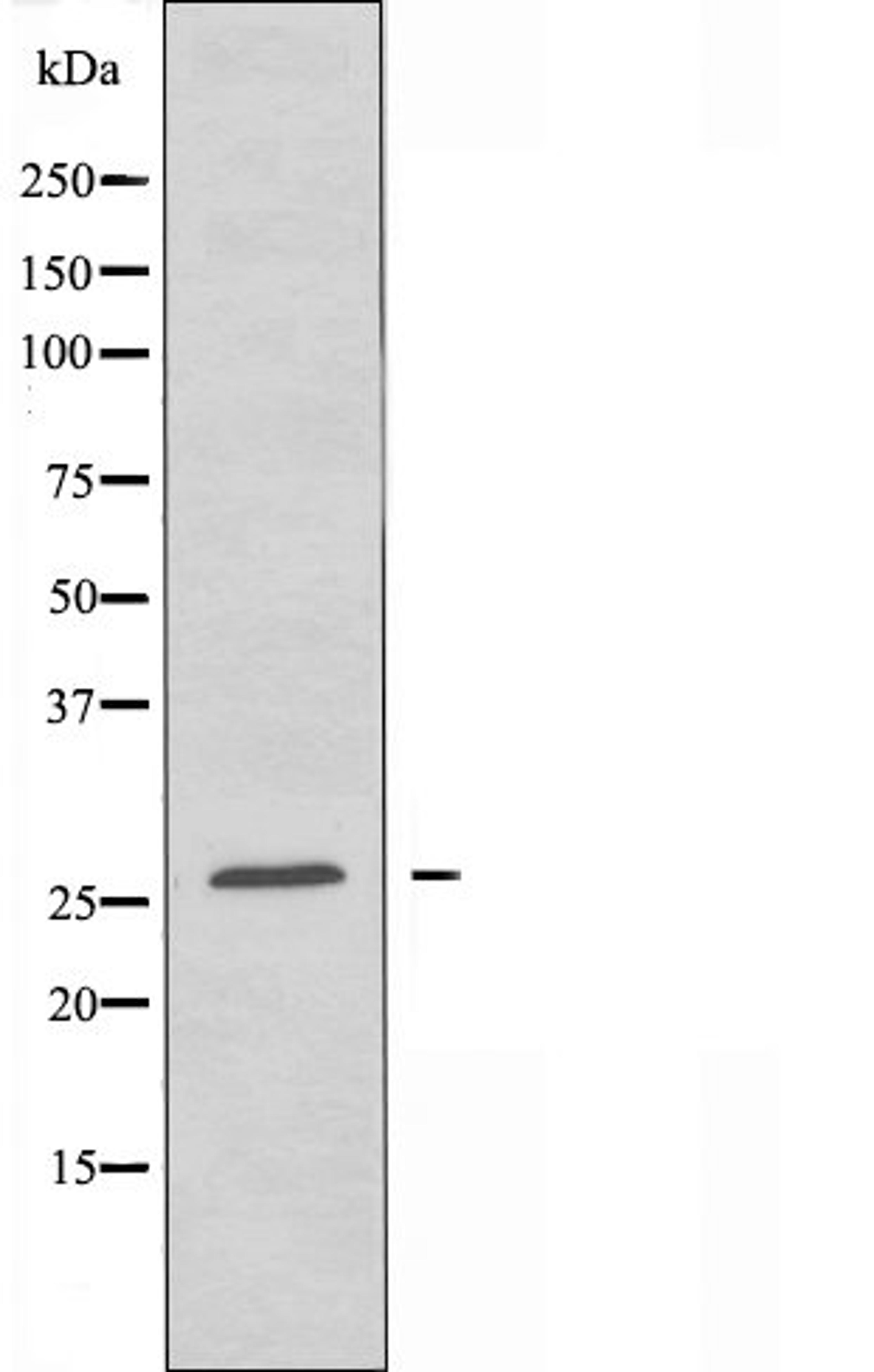 Western blot analysis of NIH/3T3 cells using OR7E5P antibody