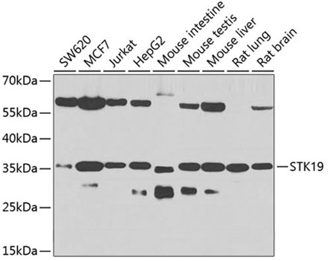 Western blot - STK19 antibody (A7574)