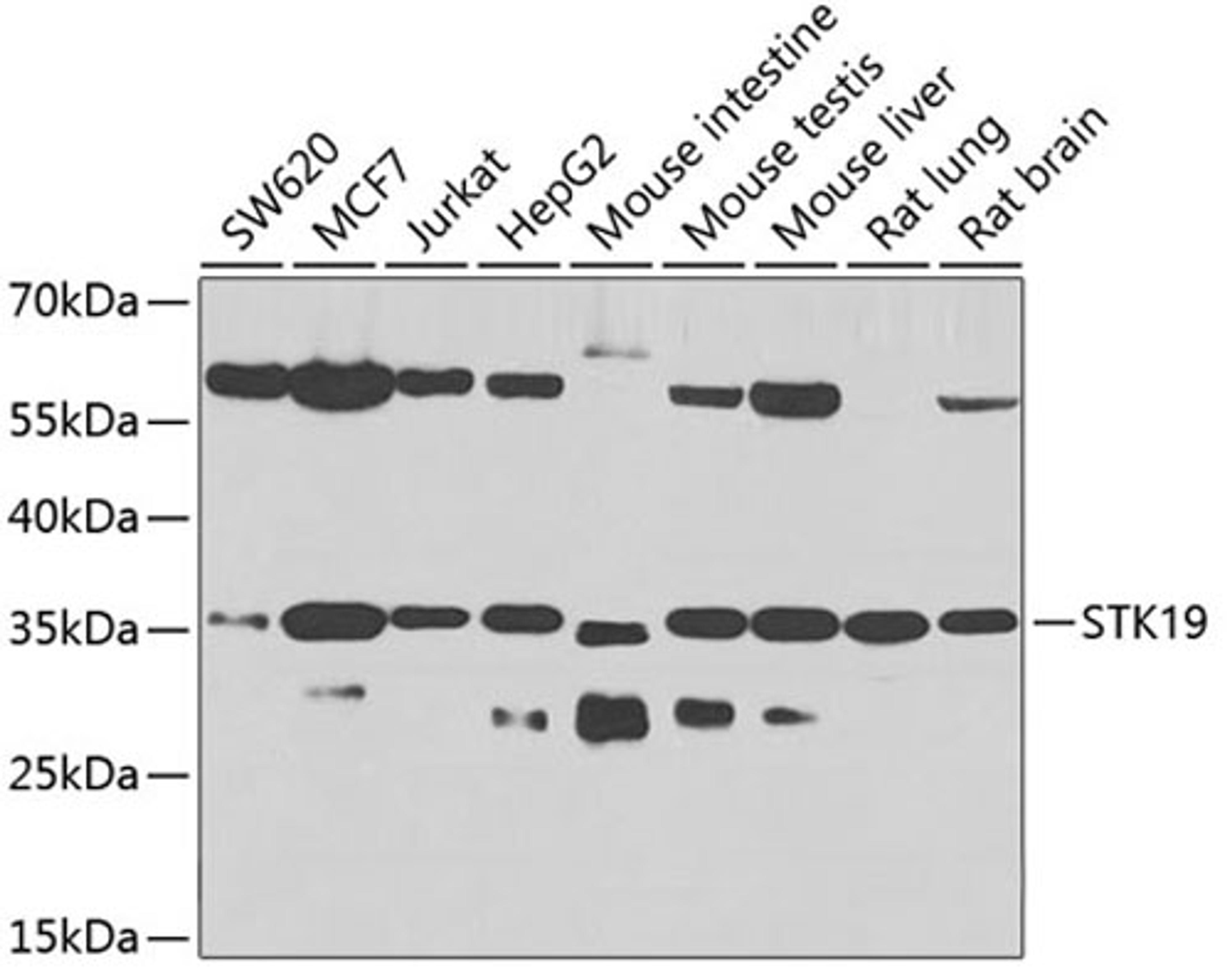 Western blot - STK19 antibody (A7574)