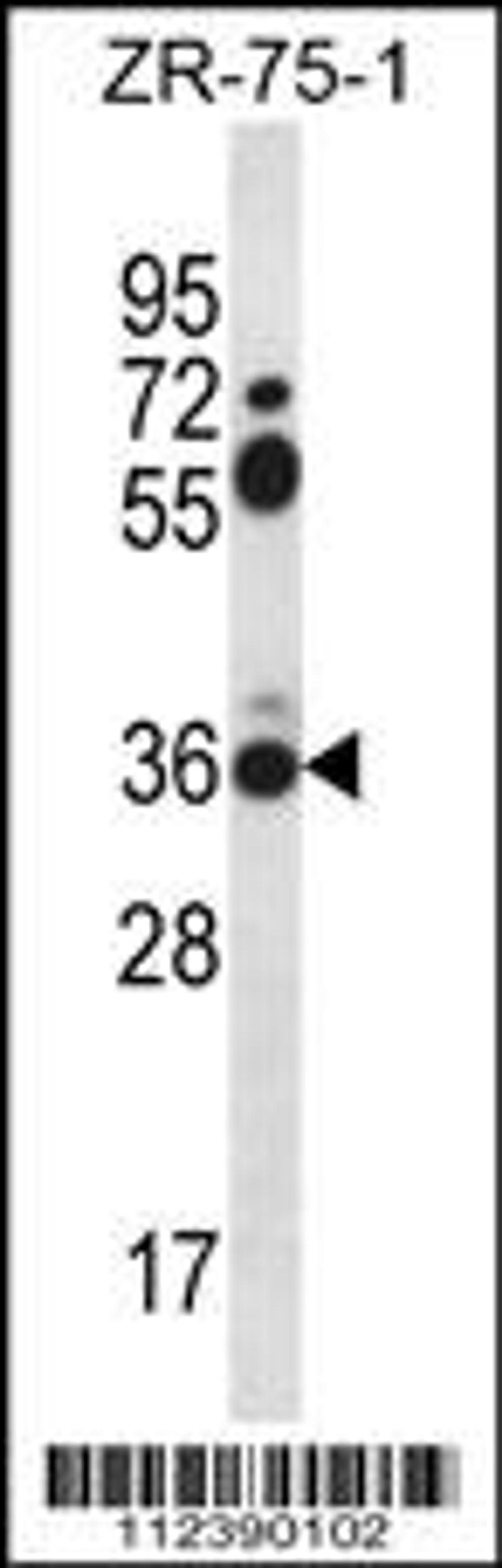 Western blot analysis in ZR-75-1 cell line lysates (35ug/lane).