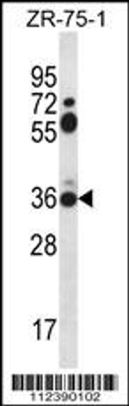 Western blot analysis in ZR-75-1 cell line lysates (35ug/lane).