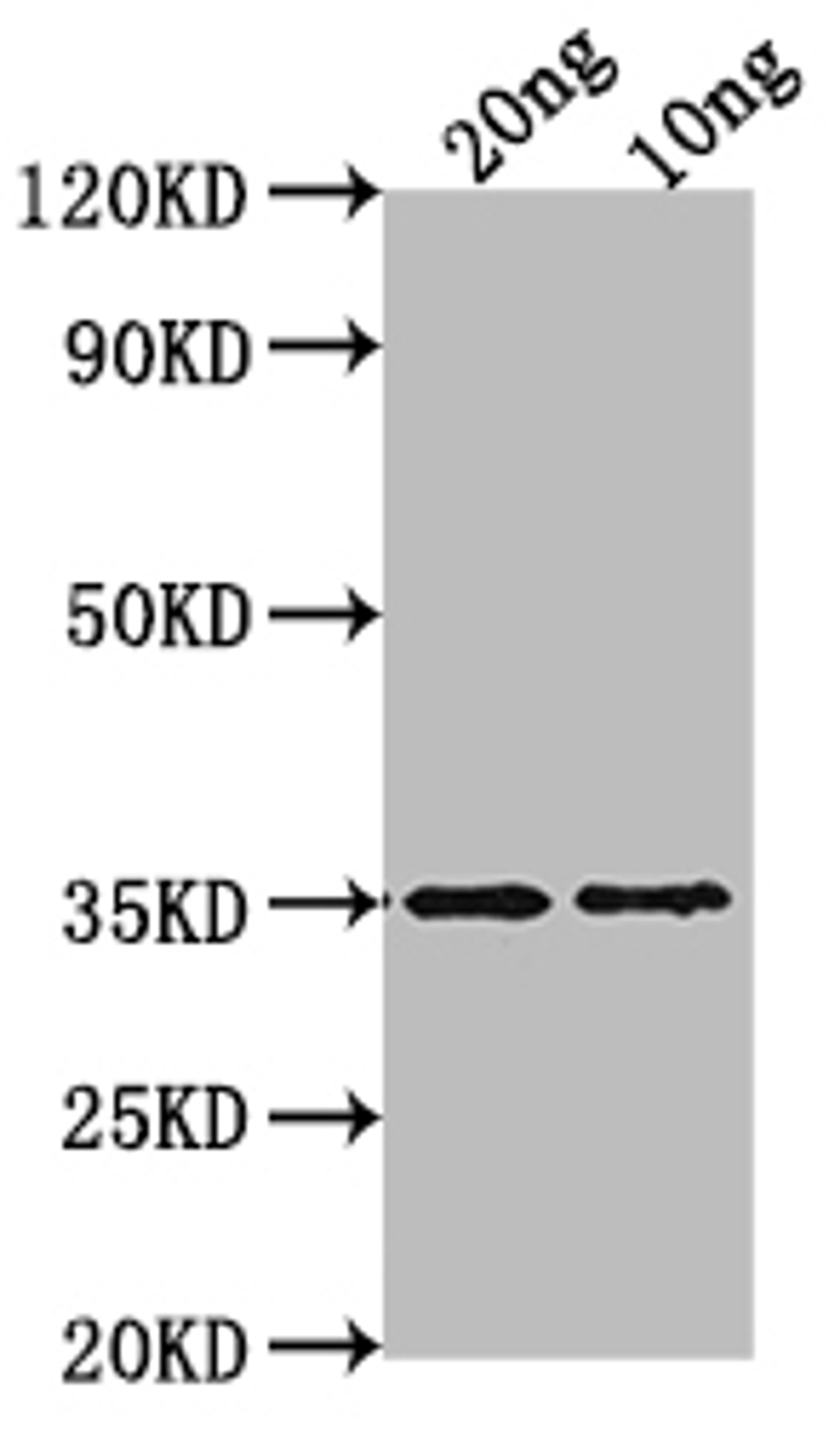 Western Blot. Positive WB detected in Recombinant protein. All lanes: WRKY47 antibody at 1:2000. Secondary. Goat polyclonal to rabbit IgG at 1/50000 dilution. Predicted band size: 35.7 kDa. Observed band size: 35 kDa. 