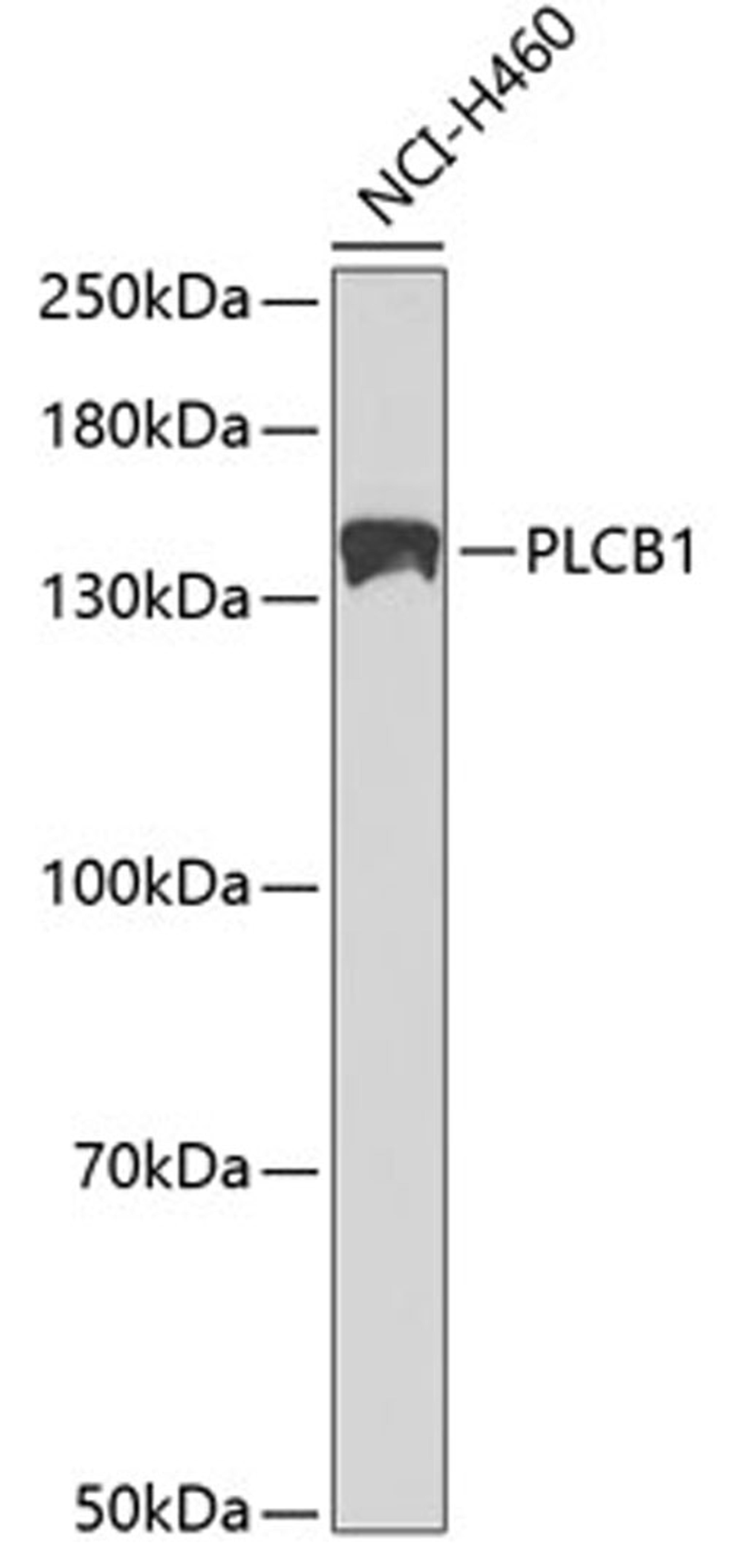 Western blot - PLCB1 antibody (A1971)