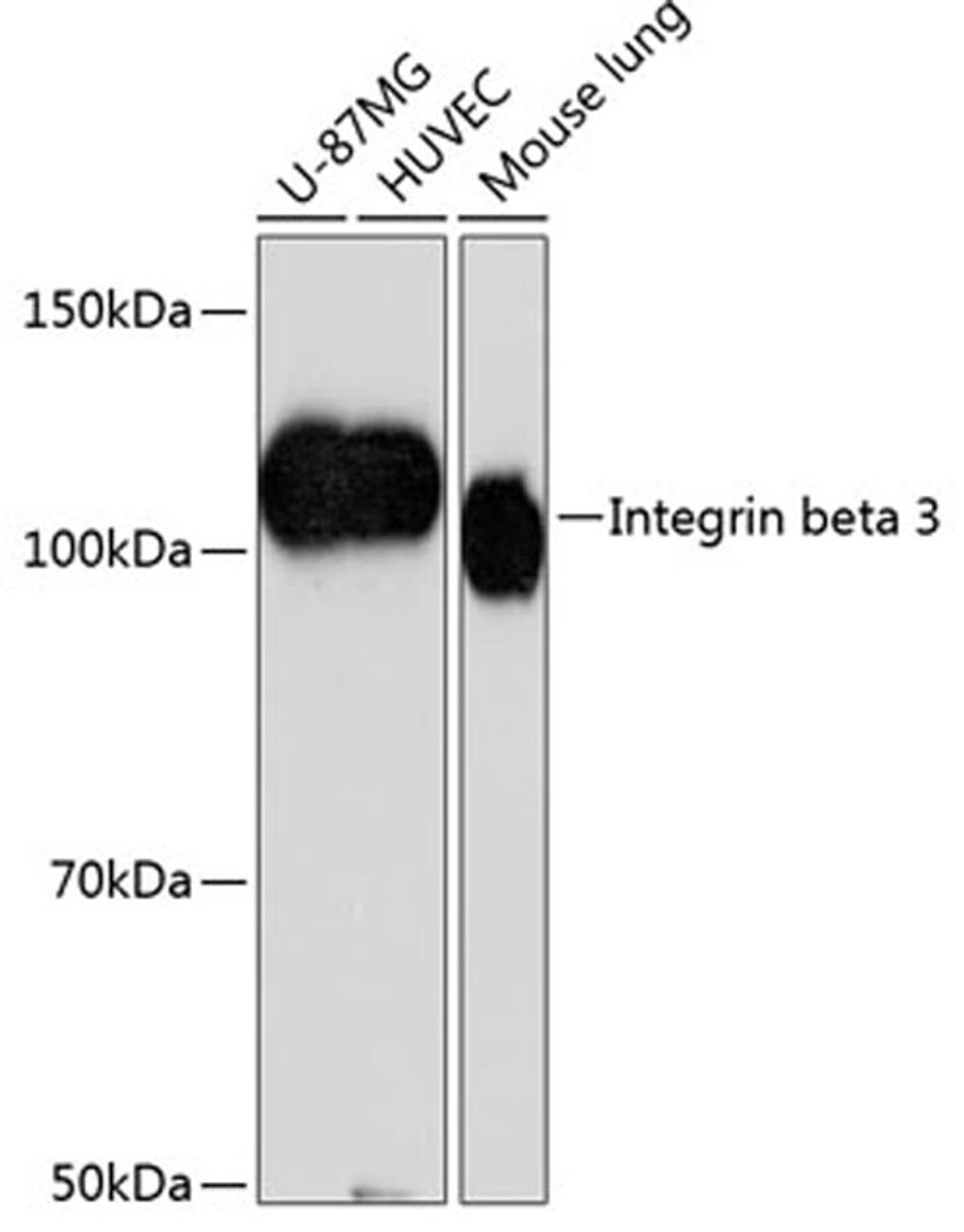 Western blot - Integrin beta 3 antibody (A19073)