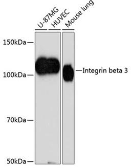 Western blot - Integrin beta 3 antibody (A19073)