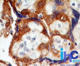 Immunohistochemistry-Paraffin: Transglutaminase 2 Antibody [NBP2-24470] - Formalin-fixed, paraffin-embedded human placenta  stained with TG2 antibody at 1 ug/ml. Note cytoplasmic staining of trophoblastic cells.